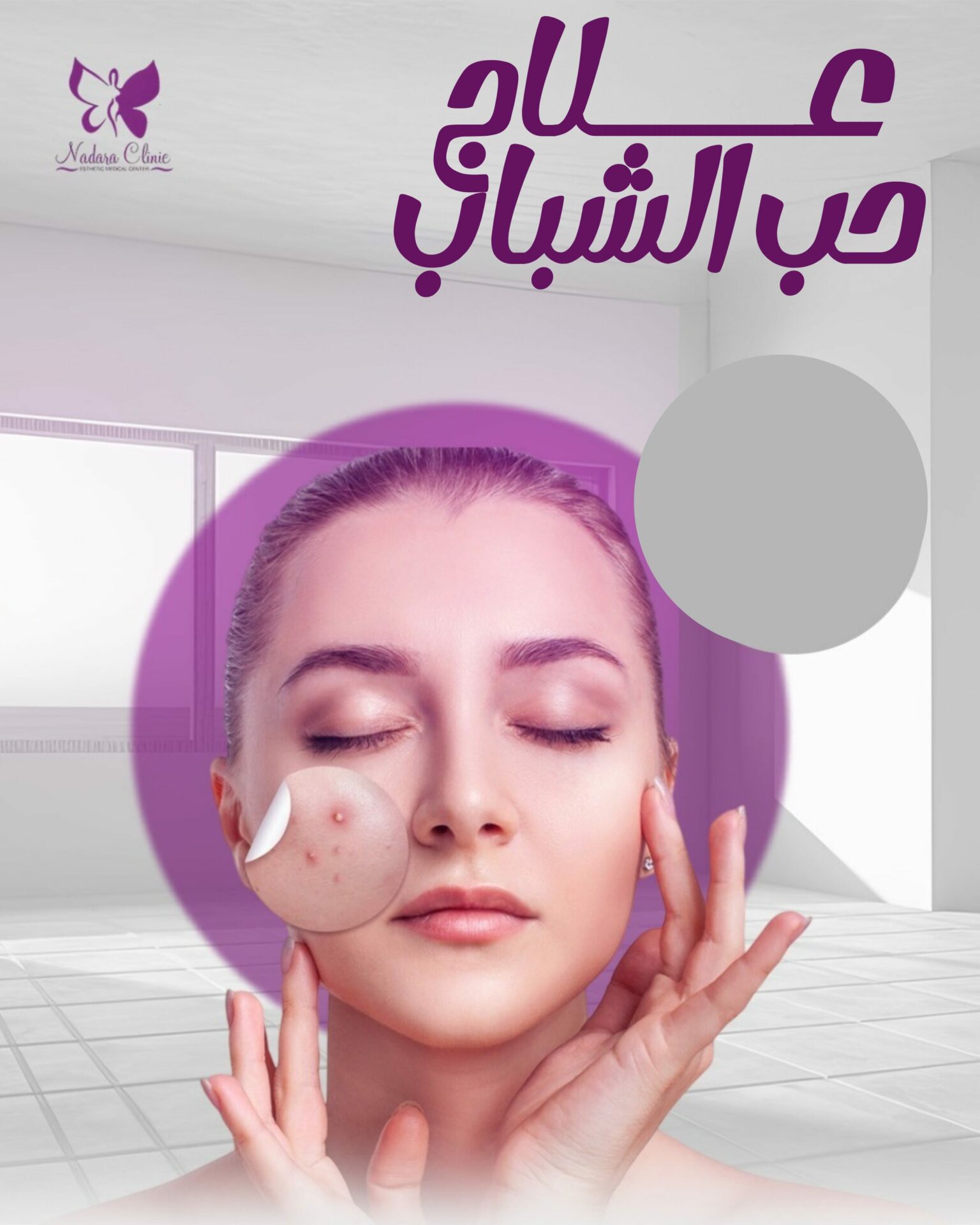 علاج حب الشباب في الغردقة